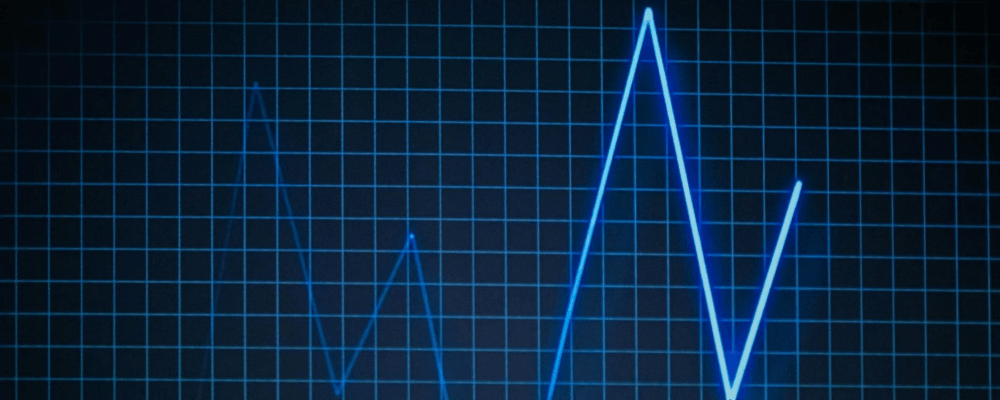 Blue line graph on a screen with dark grid background, resembling a monitoring or heartbeat-style chart with sharp peaks and drops.